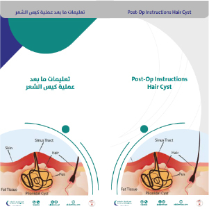 تعليمات ما بعد عملية كيس الشعر